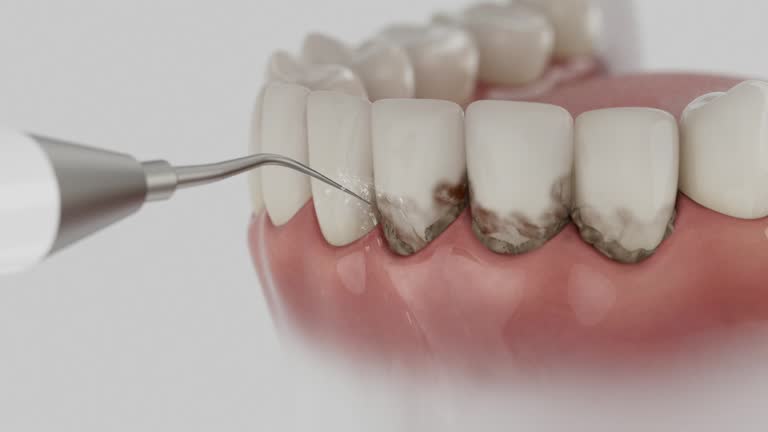 Trusted Wisdom Tooth Removal service in Guadalupe, AZ - Dentist Open Now